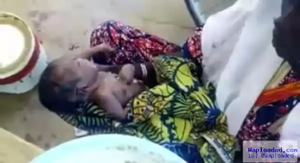 Photos: Baby born with his heart outside his body in Yobe state